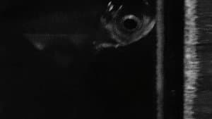 Anomalies (Fibrosis) — foto 1