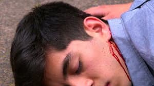 Operación skato