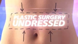 Plastic Surgery Undressed — foto 2